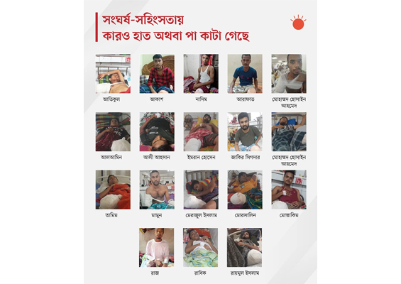 হাত–পা হারালেন ১৯ জন